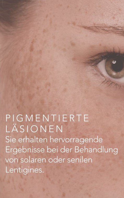 Pigmentierte Läsionen