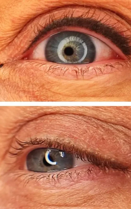 Nahaufnahme der oberen und unteren Lidlinie, die den Effekt der Eyeliner-Behandlung betont.